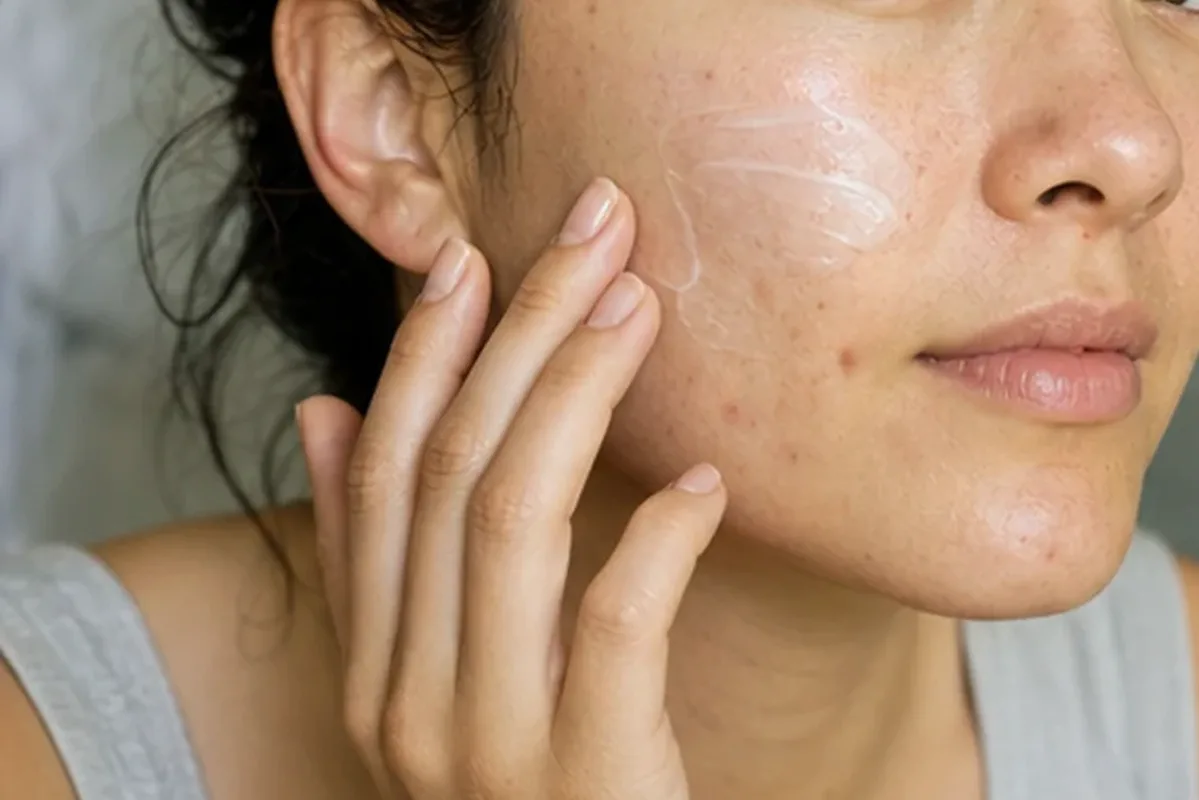 Authentischer Wohlfühlmoment passend zum Beauty-Thema Chemisches Peeling bei Pigmentflecken