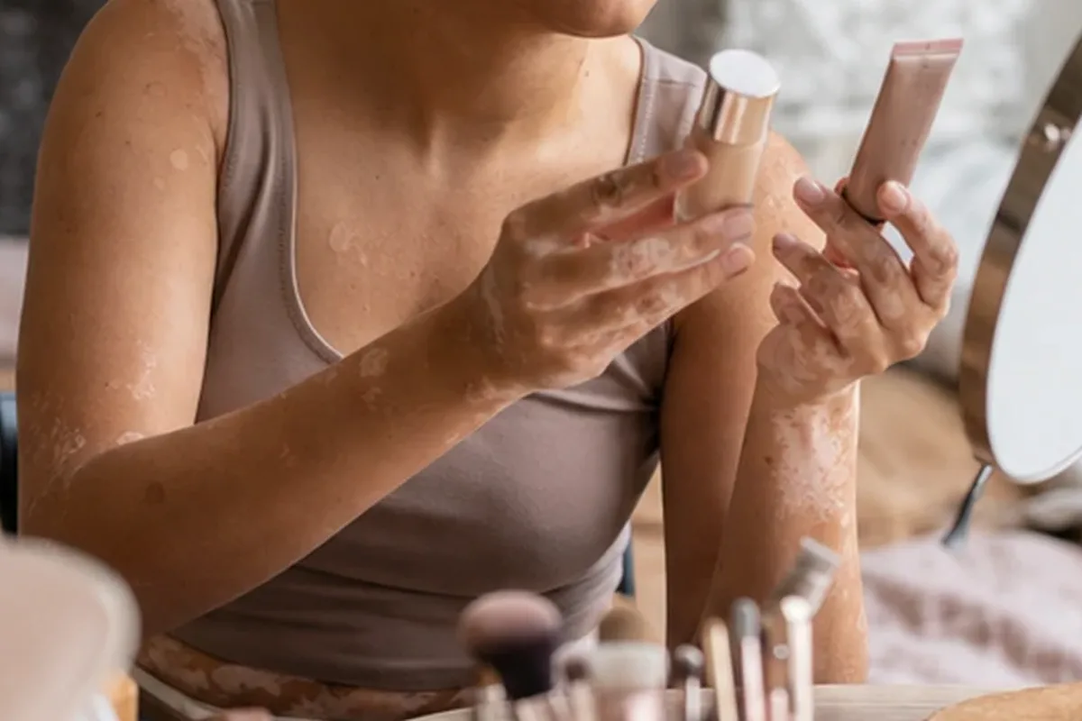 Emotionaler und authentischer Anwendungsmoment rund um Concealer bei Rötungen
