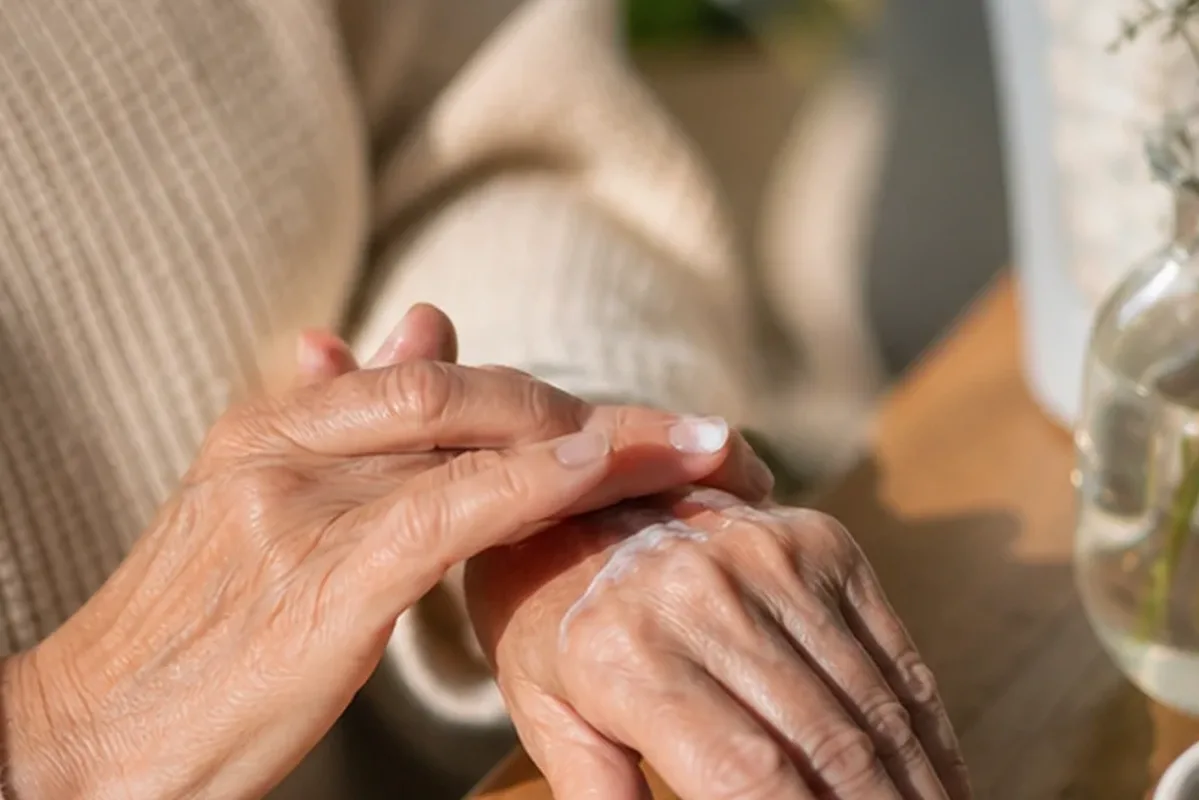 Emotionaler und authentischer Anwendungsmoment rund um After-Sun-Pflege bei Keratosis pilaris